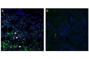 Expression of Frizzled-3 in mouse striatum.