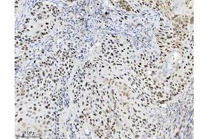 IHC analysis of MCM7 using anti-MCM7 antibody (ABIN7601968). (MCM7 anticorps  (AA 526-719))