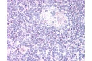 FOXN1 polyclonal antibody  staining (20 ug/mL) of paraffin embedded human thymus medulla.