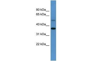 anti-Glycogenin (GYG) (C-Term) antibody