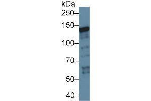 Western Blot; Sample: Human K562 cell lysate; Primary Ab: 1µg/ml Rabbit Anti-Rat XPC Antibody Second Ab: 0. (XPC anticorps  (AA 734-933))
