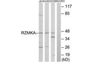 Western blot analysis of extracts from HuvEc/COS/Jurkat cells, using RIMKA Antibody. (RIMKLA anticorps  (AA 112-161))