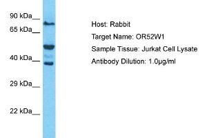 Host: Rabbit Target Name: OR52W1 Sample Type: Jurkat Whole Cell lysates Antibody Dilution: 1. (OR52W1 anticorps  (C-Term))