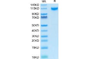 Human IL-27RA on Tris-Bis PAGE under reduced condition. (IL27 Receptor alpha Protein (AA 34-516) (Fc Tag))
