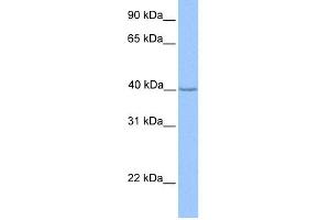 WB Suggested Anti-ZNF385D Antibody Titration:  0. (ZNF385D anticorps  (N-Term))