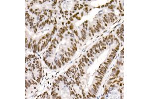 Immunohistochemistry of paraffin-embedded mouse lung using DDX3X Rabbit pAb (ABIN6130252, ABIN6139494, ABIN6139495 and ABIN6221274) at dilution of 1:100 (40x lens).