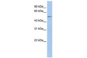 EIF5 antibody used at 1 ug/ml to detect target protein. (EIF5 anticorps  (N-Term))