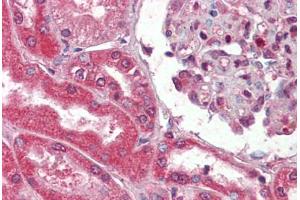 Human Kidney (formalin-fixed, paraffin-embedded) stained with Collagen I antibody ABIN462339 followed by biotinylated goat anti-rabbit IgG secondary antibody ABIN481713, alkaline phosphatase-streptavidin and chromogen. (Collagen Type I anticorps)