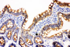 Anti- gamma Catenin Picoband antibody, IHC(P) IHC(P): Rat Intestine Tissue (JUP anticorps  (AA 556-745))