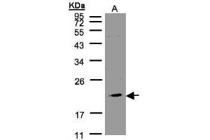 WB Image Sample(30 μg of whole cell lysate) A:293T 12% SDS PAGE antibody diluted at 1:1000 (KLRC4 anticorps  (N-Term))