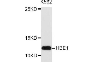 Western blot analysis of extracts of K562 cell line, using HBE1 antibody. (Hemoglobin, epsilon 1 (HBe1) anticorps)