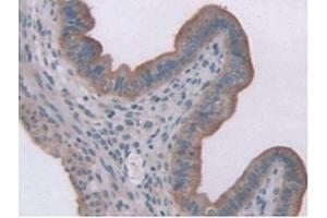IHC-P analysis of Mouse Uterus Tissue, with DAB staining. (Leptin Receptor anticorps  (AA 22-203))