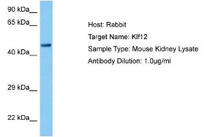 Host:  Mouse  Target Name:  KLF12  Sample Tissue:  Mouse Kidney  Antibody Dilution:  1ug/ml