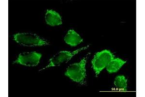 Immunofluorescence of purified MaxPab antibody to DLAT on HeLa cell.