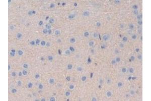 Detection of IL35 in Mouse Cerebrum Tissue using Polyclonal Antibody to Interleukin 35 (IL35) (Interleukin 35 anticorps  (AA 23-215))
