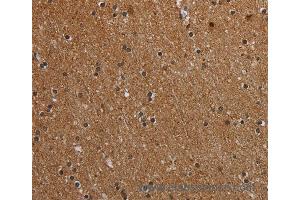 Immunohistochemistry of Human brain  using MT-ND1 Polyclonal Antibody at dilution of 1:50 (MT-ND1 anticorps)