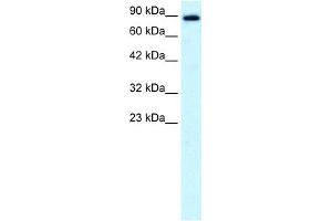WB Suggested Anti-KIF21A Antibody Titration:  0. (KIF21A anticorps  (N-Term))