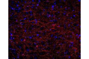 Indirect immunostaining of PFA fixed rat brain section (dilution 1 : 500; red). (Cnpase anticorps)