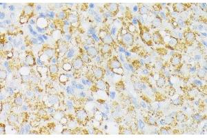 Immunohistochemistry of paraffin-embedded Rat ovary using USP33 Polyclonal Antibody at dilution of 1:100 (40x lens).