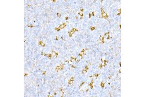 anti-Cathepsin D (CTSD) (AA 65-412) antibody