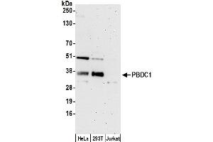 anti-Chromosome X Open Reading Frame 26 (CXorf26) (AA 183-233) antibody