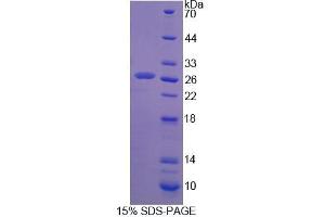 SDS-PAGE analysis of Rat SSA1 Protein. (TRIM21 Protéine)