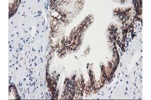 Image no. 2 for anti-Vascular Cell Adhesion Molecule 1 (VCAM1) antibody (ABIN1497155)