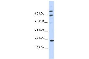 C21ORF87 antibody used at 1 ug/ml to detect target protein. (BRWD1-AS2 anticorps)