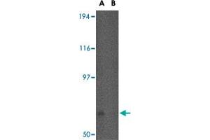 Western blot analysis of FNBP1L in human brain tissue lysate in (A) the absence and (B) the presence of blocking peptide with FNBP1L polyclonal antibody  at 0. (FNBP1L anticorps  (N-Term))