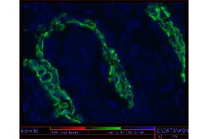 anti-Keratin 17 (KRT17) antibody