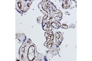 Immunohistochemistry of paraffin-embedded human placenta using Tryptophanyl-tRNA synthetase 1 Rabbit mAb (ABIN1678761, ABIN3018963, ABIN3018964 and ABIN7101695) at dilution of 1:100 (40x lens).