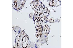 Immunohistochemistry of paraffin-embedded human placenta using Tryptophanyl-tRNA synthetase 1 Rabbit mAb (ABIN1678761, ABIN3018963, ABIN3018964 and ABIN7101695) at dilution of 1:100 (40x lens). (WARS anticorps)