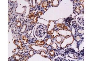 Formalin-fixed and paraffin embedded rat kidney tissue labeled Anti-CD117/c-kit/SCFR Polyclonal Antibody, Unconjugated  at 1:200, followed by conjugation to the secondary antibody and DAB staining