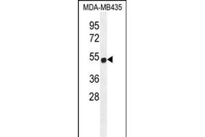 ZNF286B Antibody (N-term) (ABIN655669 and ABIN2845137) western blot analysis in MDA-M cell line lysates (35 μg/lane). (ZNF286B anticorps  (N-Term))