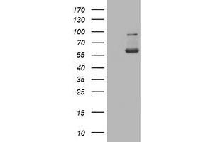 Western Blotting (WB) image for anti-PKM1 antibody (ABIN2729046) (PKM1 anticorps)