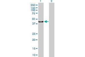 Western Blot analysis of C13orf31 expression in transfected 293T cell line by C13orf31 MaxPab polyclonal antibody. (LACC1 anticorps  (AA 1-430))
