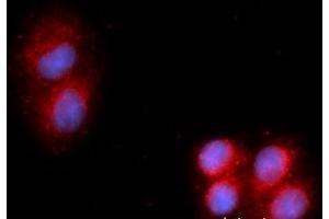 Immunofluorescence (IF) image for anti-Acid Phosphatase, Prostate (ACPP) (AA 33-386) antibody (APC) (ABIN5564801) (ACPP anticorps  (AA 33-386) (APC))