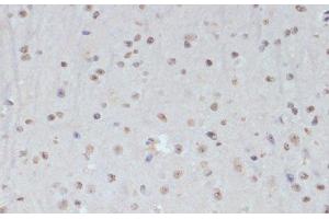 Immunohistochemistry of paraffin-embedded Mouse brain using Phospho-CDK1(Y15) Polyclonal Antibody at dilution of 1:100 (40x lens). (CDK1 anticorps  (pTyr15))