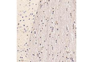 Immunohistochemistry of paraffin embedded mouse brain using RANBP6 (ABIN7075361) at dilution of 1:700 (300x lens) (RANBP6 anticorps)