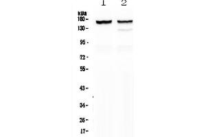 Western blot analysis of MYBPC3 using anti-MYBPC3 antibody .