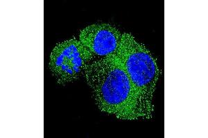 Confocal immunofluorescent analysis of P Antibody (Center) 13689c with HepG2 cell followed by Alexa Fluor 488-conjugated goat anti-rabbit lgG (green).