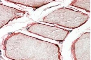 Image no. 1 for anti-Caveolin 3 (CAV3) (N-Term) antibody (ABIN375161) (Caveolin 3 anticorps  (N-Term))