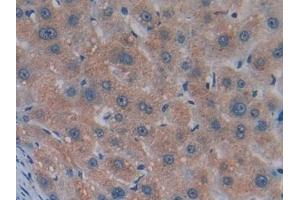 Detection of MSTN in Human Liver Tissue using Monoclonal Antibody to Myostatin (MSTN)