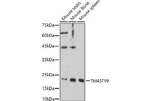 Western blot analysis of extracts of various cell lines, using TM4SF19 antibody (ABIN7270936) at 1:1000 dilution. (TM4SF19 anticorps  (AA 50-150))