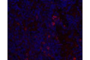 Immunofluorescence analysis of paraffin-embedded mouse inflammatory spleen using IL2 Polyclonal Antibody at dilution of 1:300. (IL-2 anticorps)