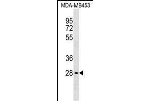 GBL Antibody (C-term) (ABIN1537039 and ABIN2838246) western blot analysis in MDA-M cell line lysates (35 μg/lane). (GBL anticorps  (C-Term))