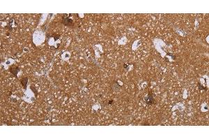 Immunohistochemistry of paraffin-embedded Human brain tissue using LIMK1 Polyclonal Antibody at dilution 1:40 (LIM Domain Kinase 1 anticorps)