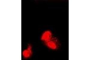 Immunofluorescent analysis of SIAH1 staining in U2OS cells.