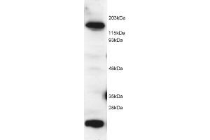 ABIN184584 (2 µg/mL) staining of Hela lysate (RIPA buffer, 1. (MTR anticorps  (C-Term))
