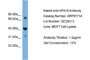 WB Suggested Anti-VPS16  Antibody Titration: 0. (VPS16 anticorps  (Middle Region))